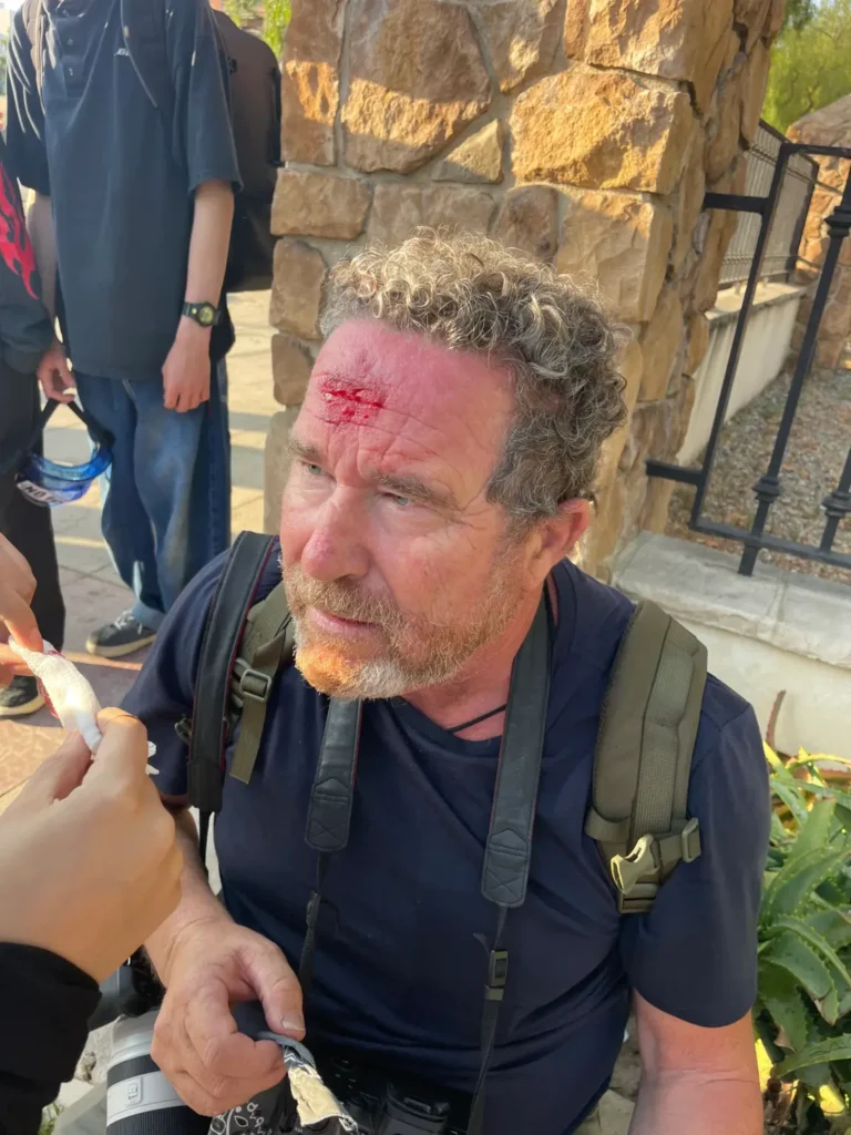 Press photographer gets shot in the head by a rubber bullet during LA’s anti-ICE unrest — and the footage is chilling Press photographer gets shot in the head by a rubber bullet during LA’s anti-ICE unrest — and the footage is chilling