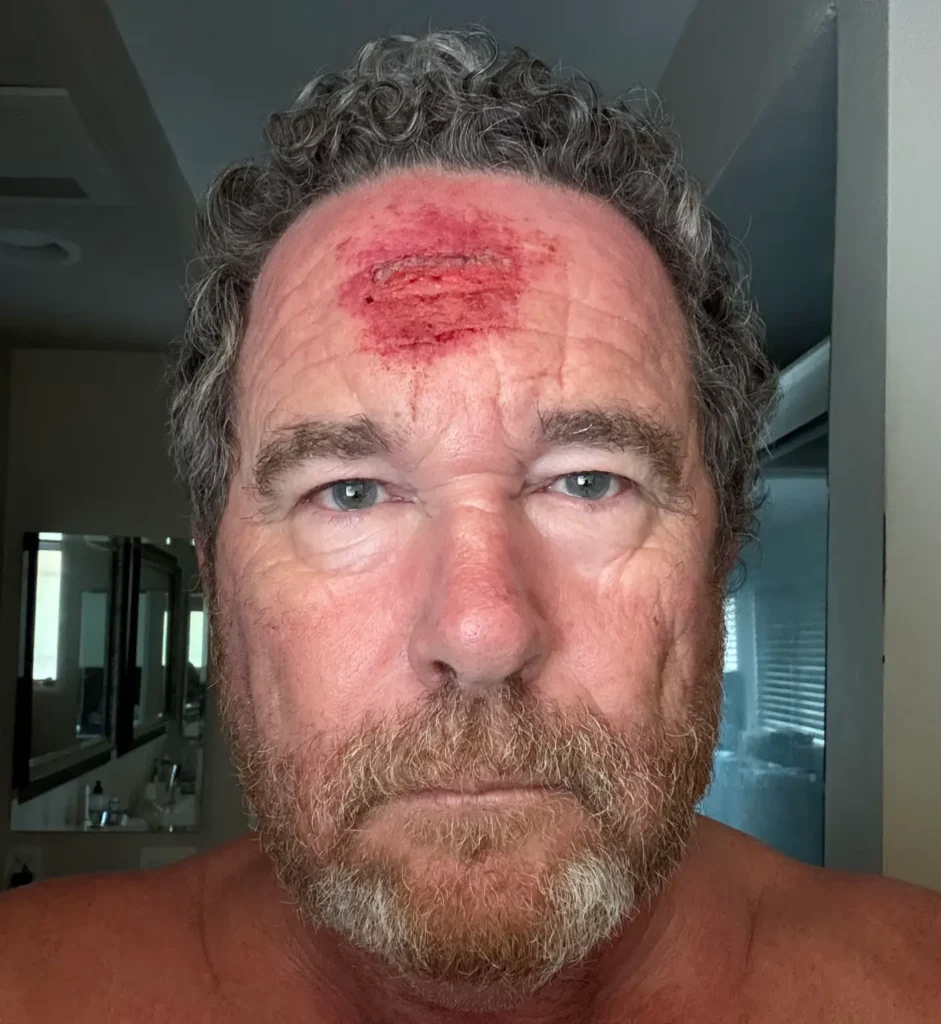 Press photographer gets shot in the head by a rubber bullet during LA’s anti-ICE unrest — and the footage is chilling Press photographer gets shot in the head by a rubber bullet during LA’s anti-ICE unrest — and the footage is chilling